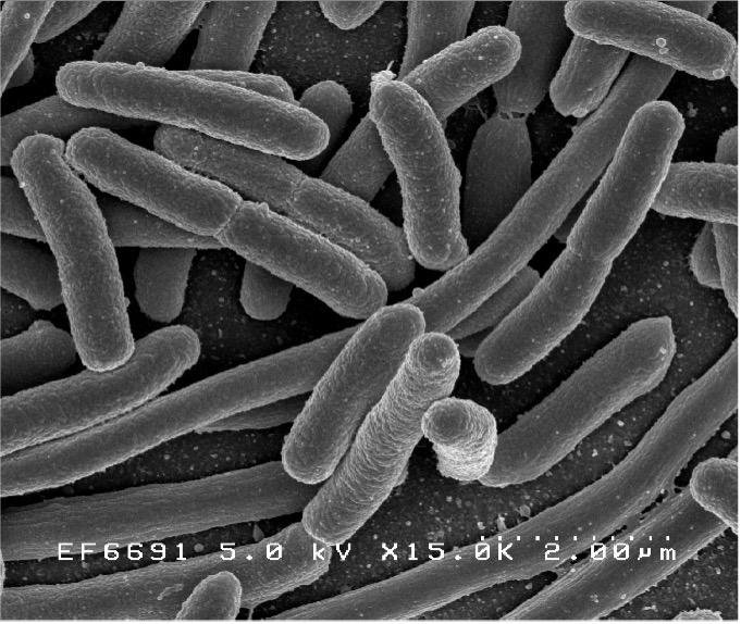 COLIFORM VÀ E.COLI
